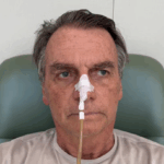 Bolsonaro deixa UTI e segue recuperação em quarto comum após cirurgia no intestino