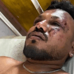 Sobrevivente do voo da Air India relata momento da queda: “Tudo aconteceu muito rápido”