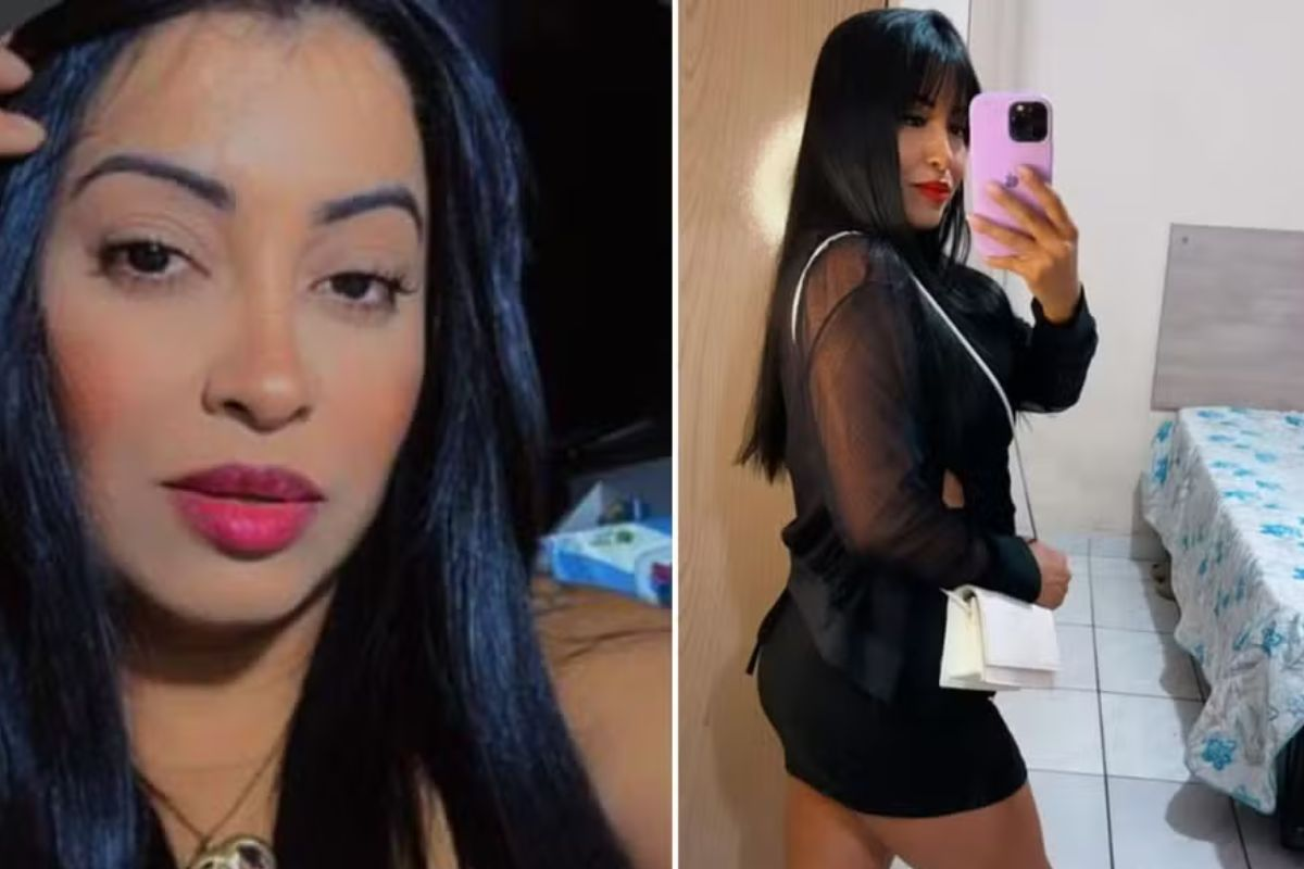 Mulher morre após complicações em procedimento estético com hidrogel
