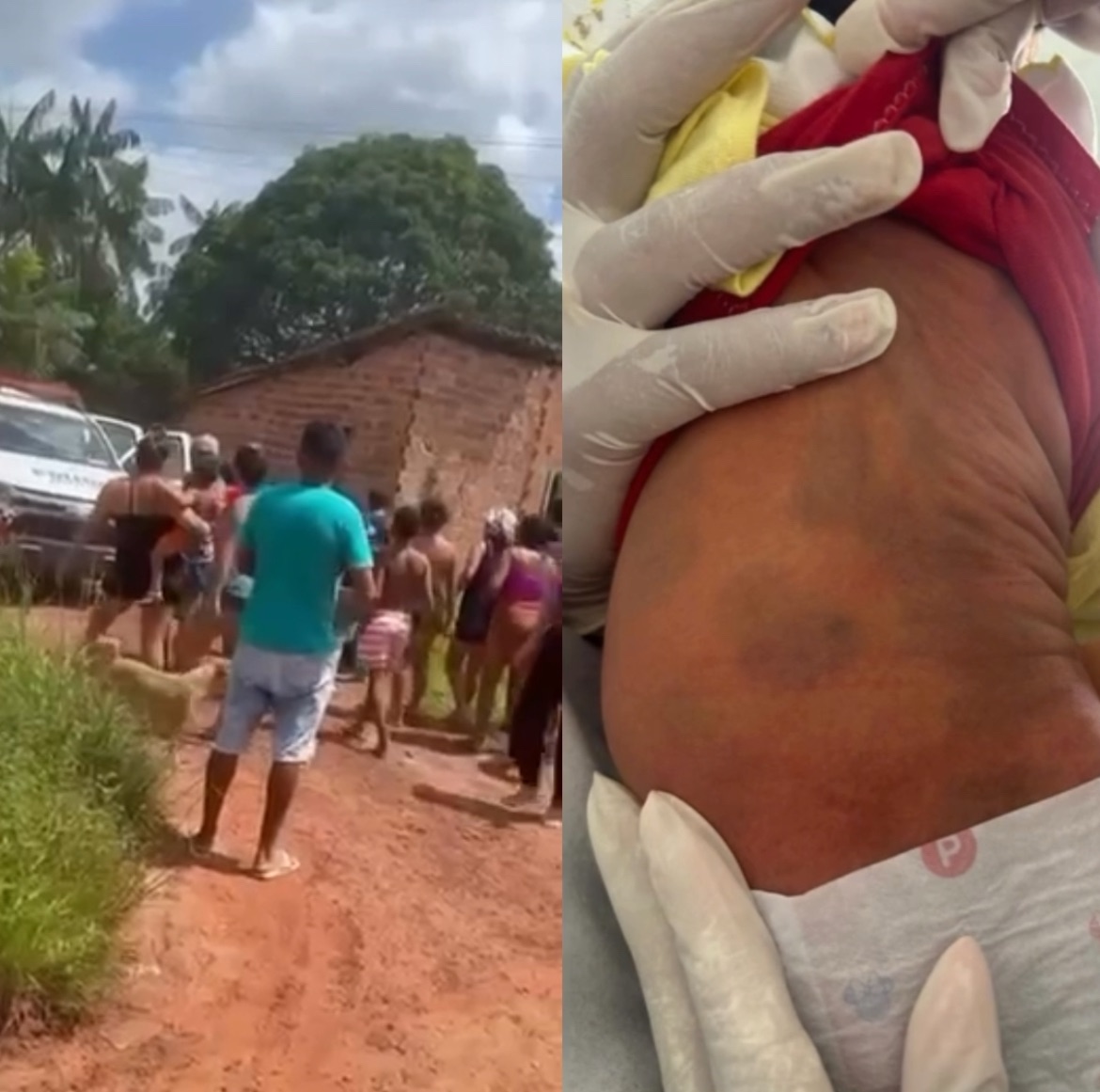 Pai preso por suspeita de espancar bebê no Pará é vítima de erro