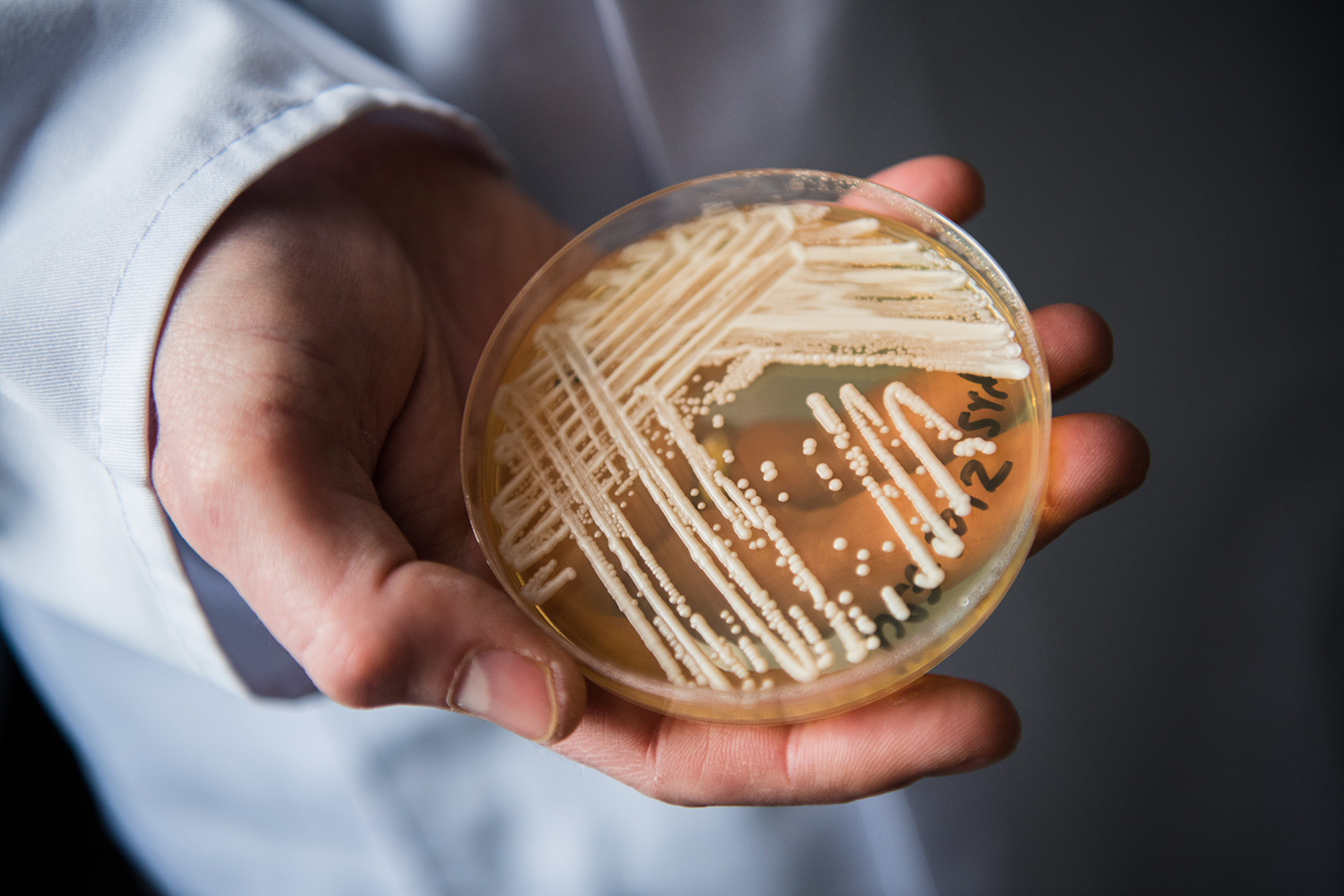 Natal confirma primeiro caso do “superfungo” Candida auris e acende alerta em hospitais