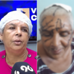 Mulher sobrevive a ataque de facão, leva 180 pontos na cabeça e teme libertação do agressor