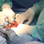 Justiça condena Estado do RN a indenizar paciente após erro em cirurgia provocar lesão permanente