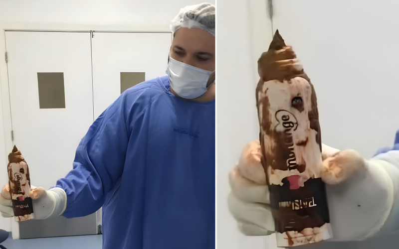 Homem dá entrada no hospital com dores e médicos encontram desodorante de 14 cm no reto