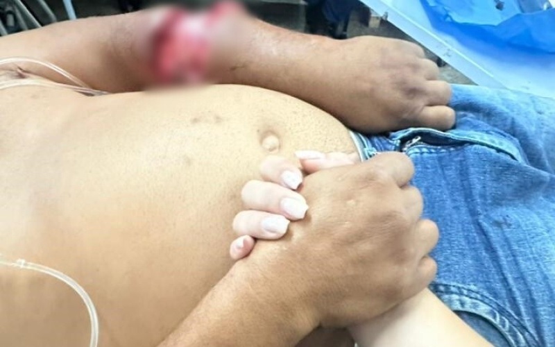 Homem é atacado pelo próprio pitbull em Areia Branca e precisa ser transferido para hospital em Mossoró