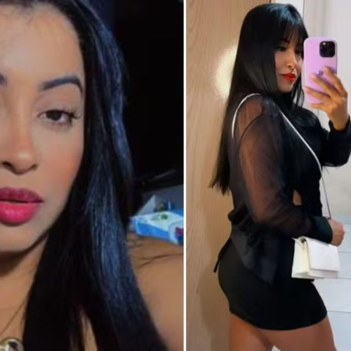Mulher morre após complicações em procedimento estético com hidrogel