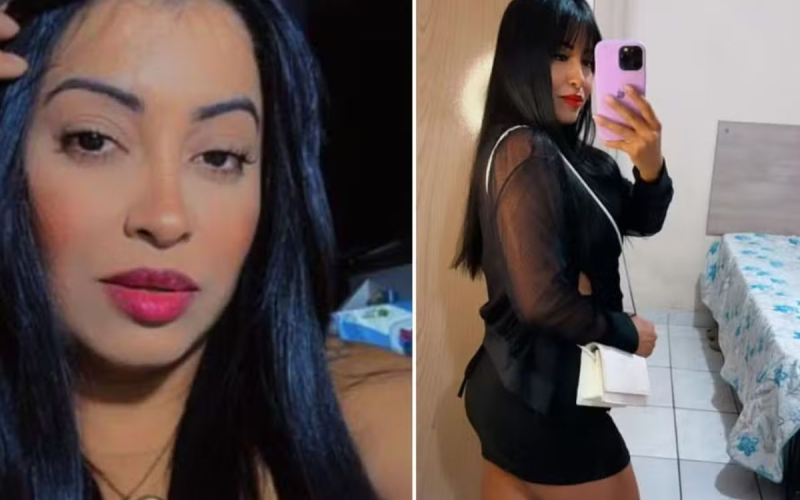 Mulher morre após complicações em procedimento estético com hidrogel