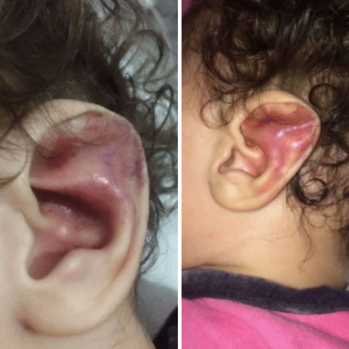 Mãe condenada por tortura de bebê é presa em Praia Grande após decisão definitiva da Justiça