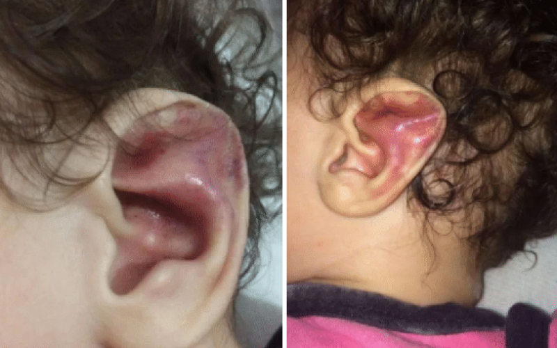 Mãe condenada por tortura de bebê é presa em Praia Grande após decisão definitiva da Justiça