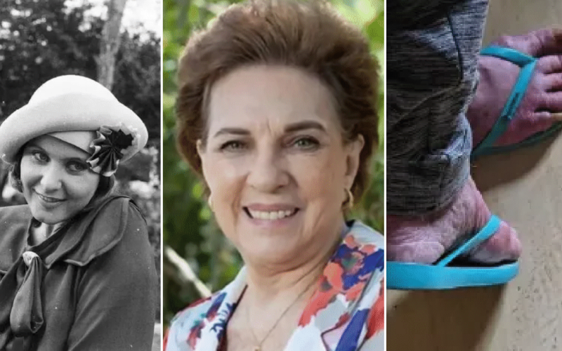 Ex-atriz da Globo, Rejane Schumann é encontrada em situação de abandono em Porto Alegre