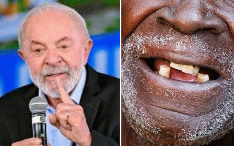 “Negro e sem dente”: Lula critica uso de foto em campanha e gera polêmica