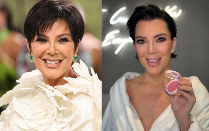 Kris Jenner surpreende com rosto 20 anos mais jovem — médico explica