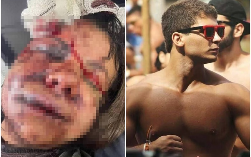 Polícia conclui inquérito e indicia Igor Cabral por tentativa de feminicídio