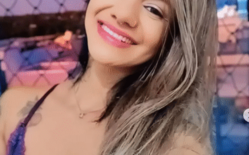 Juliana Soares recebe alta após reconstrução facial, mas ainda pode passar por novas cirurgias
