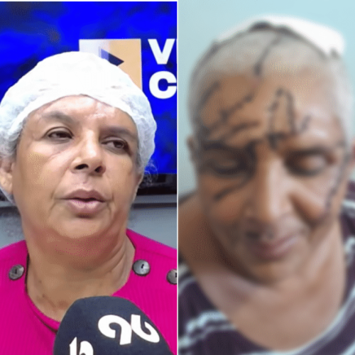 Mulher sobrevive a ataque de facão, leva 180 pontos na cabeça e teme libertação do agressor