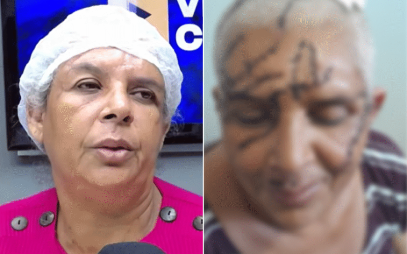 Mulher sobrevive a ataque de facão, leva 180 pontos na cabeça e teme libertação do agressor