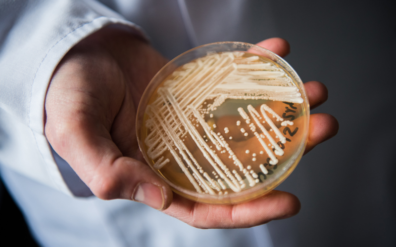 Natal confirma primeiro caso do “superfungo” Candida auris e acende alerta em hospitais