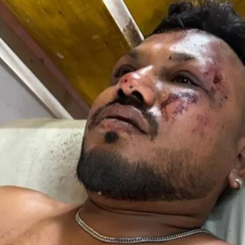 Sobrevivente do voo da Air India relata momento da queda: “Tudo aconteceu muito rápido”