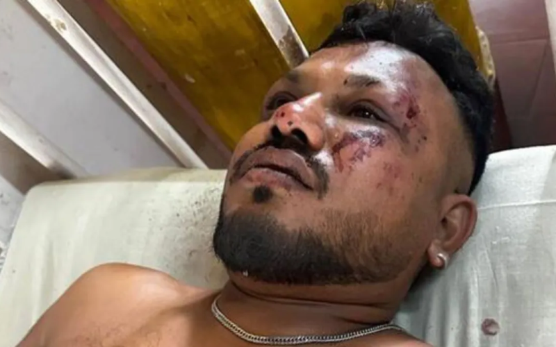 Sobrevivente do voo da Air India relata momento da queda: “Tudo aconteceu muito rápido”