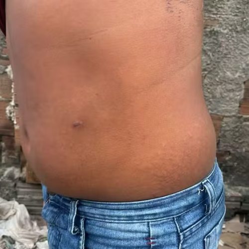 Militar do Exército confessa ter atirado contra carro e ferido adolescente de 12 anos em Parnamirim