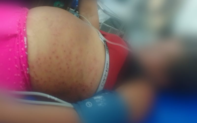 Mulher é internada em estado grave após ataque de abelhas na Grande Natal